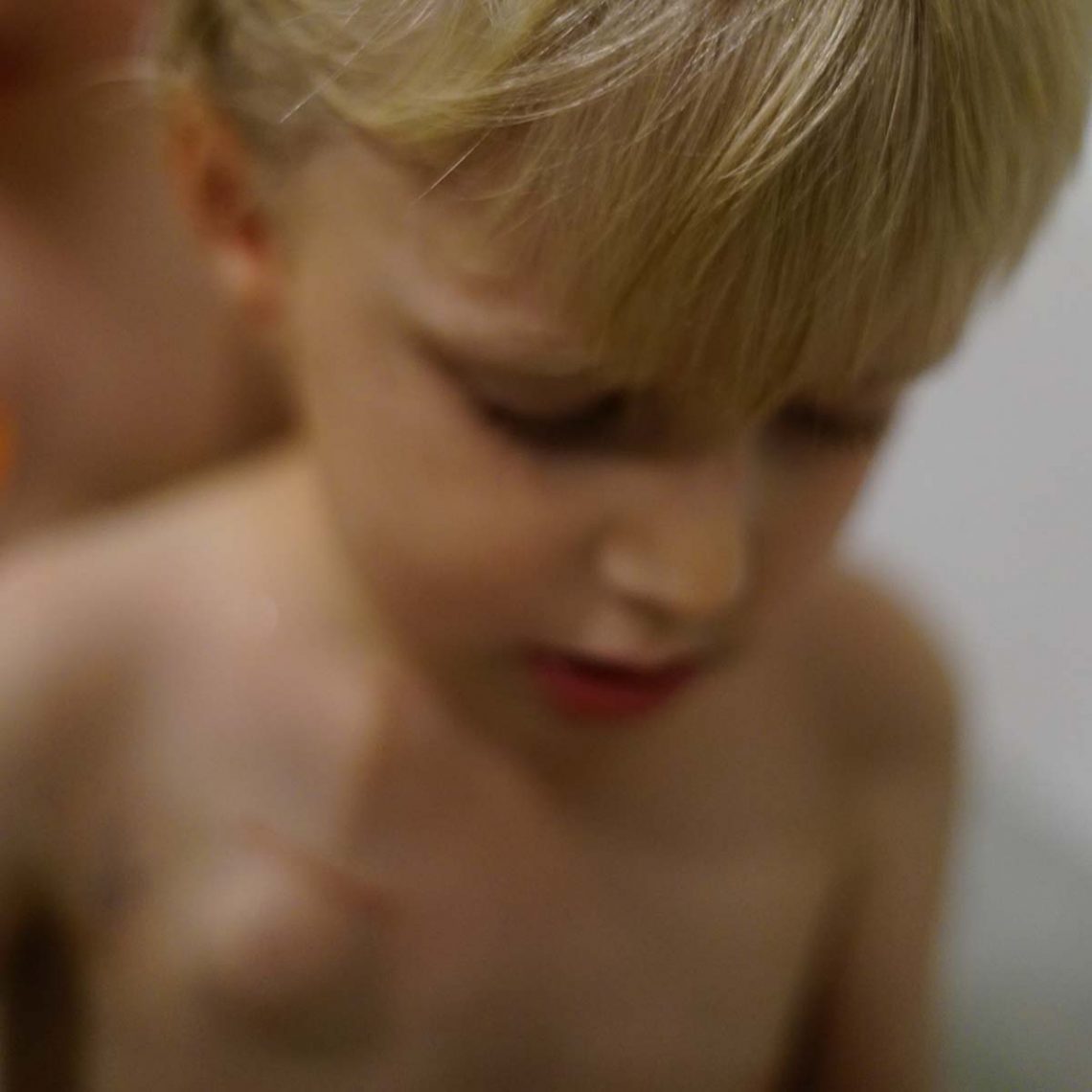 Elis i badet, med port-a-kathen synlig på bröstet.