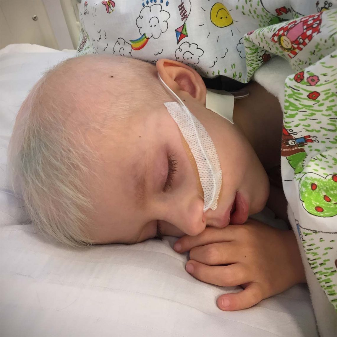 Elis, fortfarande sövd, har precis fått sond i näsan.