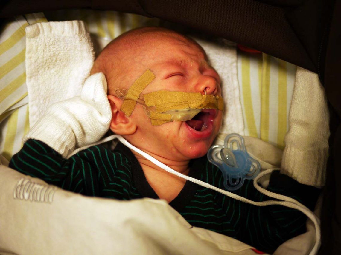 Elis skriker i vagnen med sond i näsan.