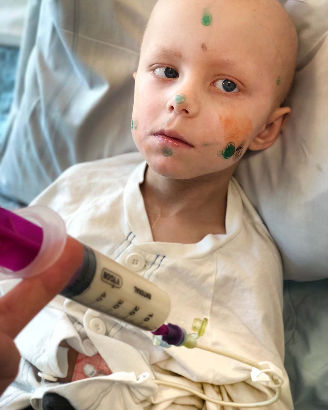 Elis får sondnäring på sjukhuset