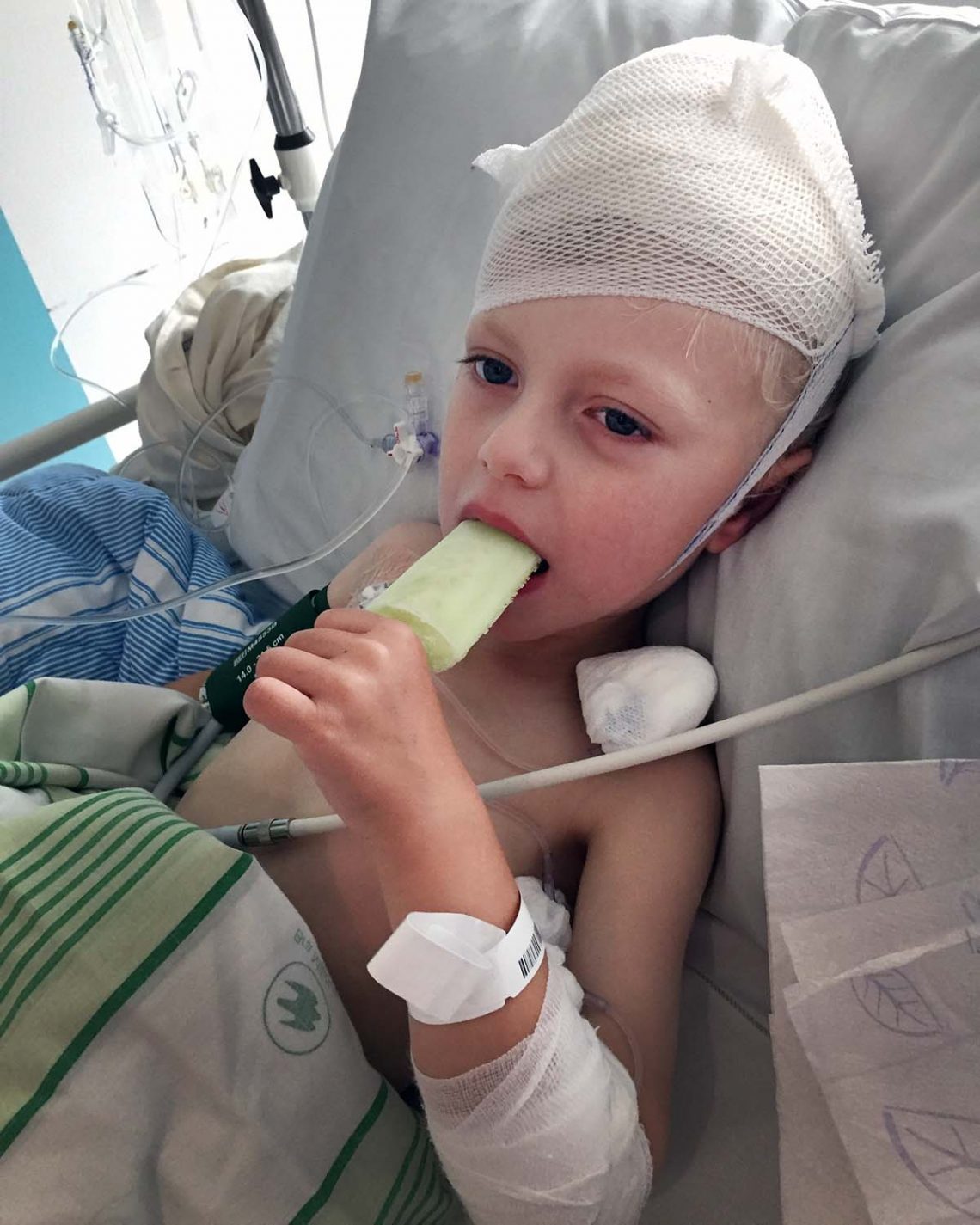 Elis äter Piggelin efter den första operationen som lättade på trycket i hjärnan