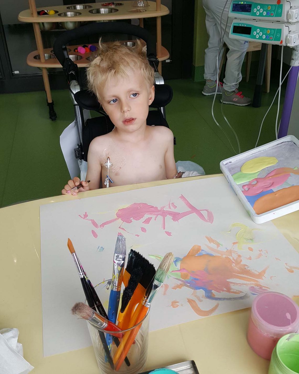 Elis, nyopererad, på lekterapin. 22 augusti 2017