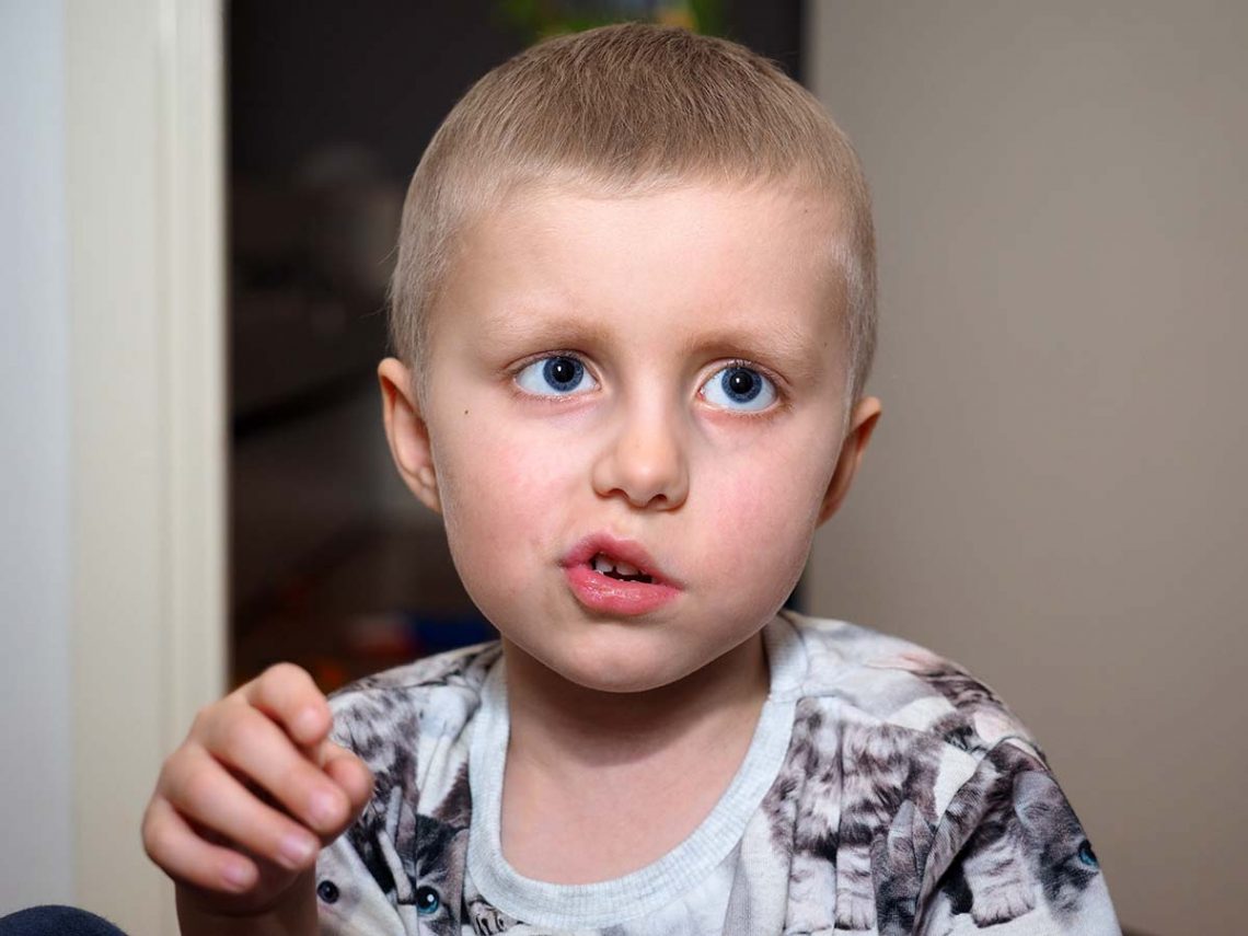 Elis i sin tröja med katter på. Håret har börjat växa tätt på huvudet.