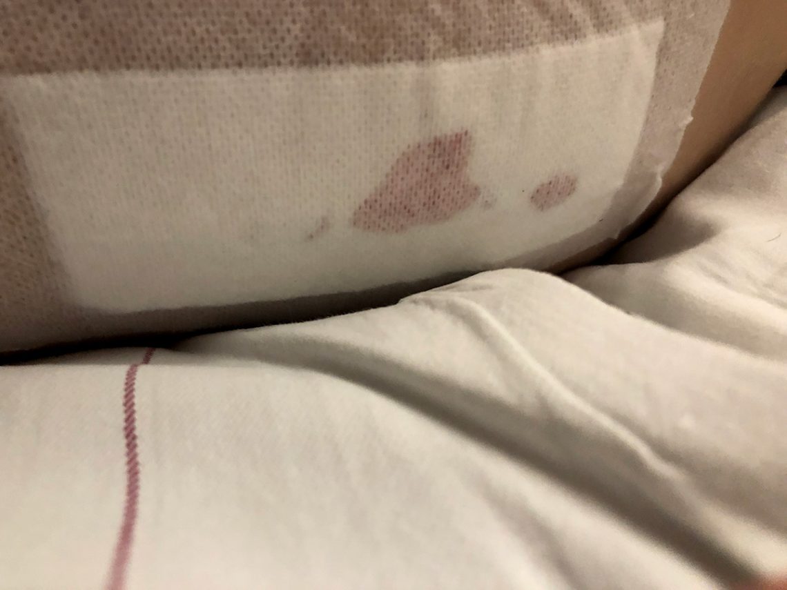 Elis kompress efter ryggoperationen, med en blodfläck som liknar ett hjärta