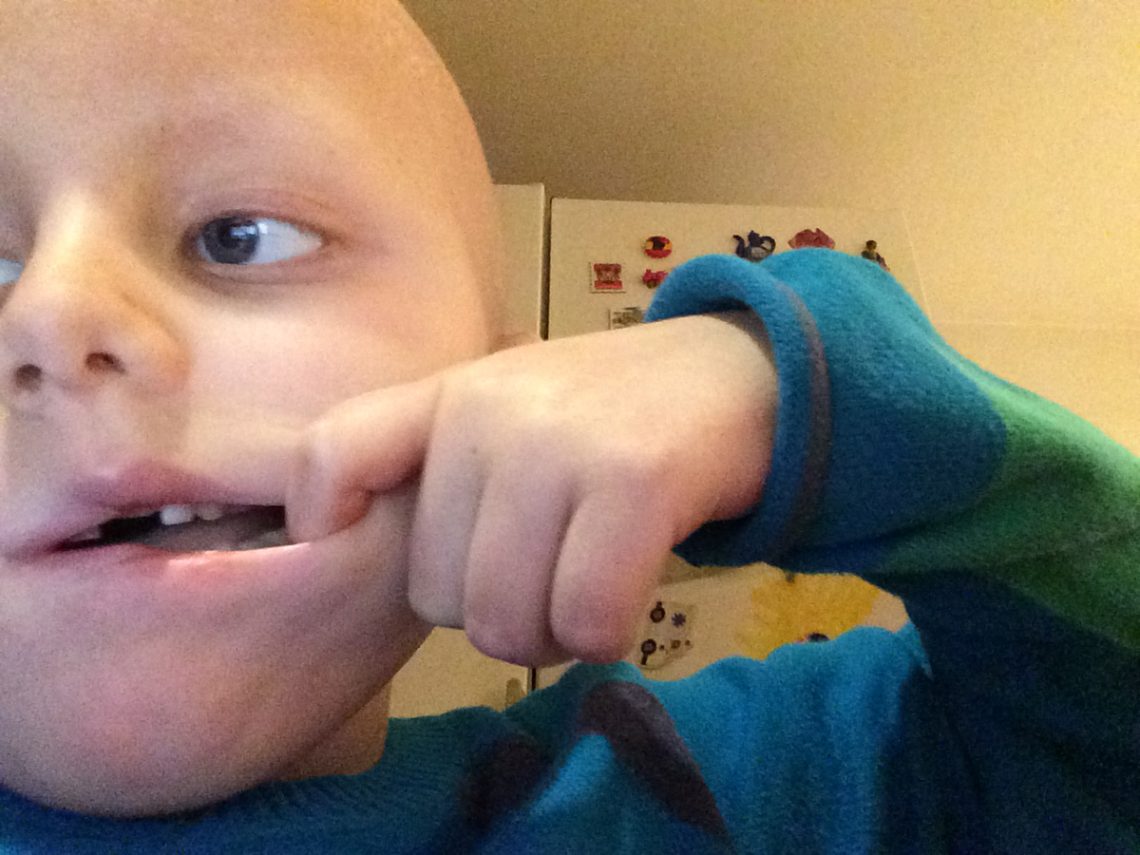 Elis drar i mungipan på den sida där hans ansikte är förlamat.