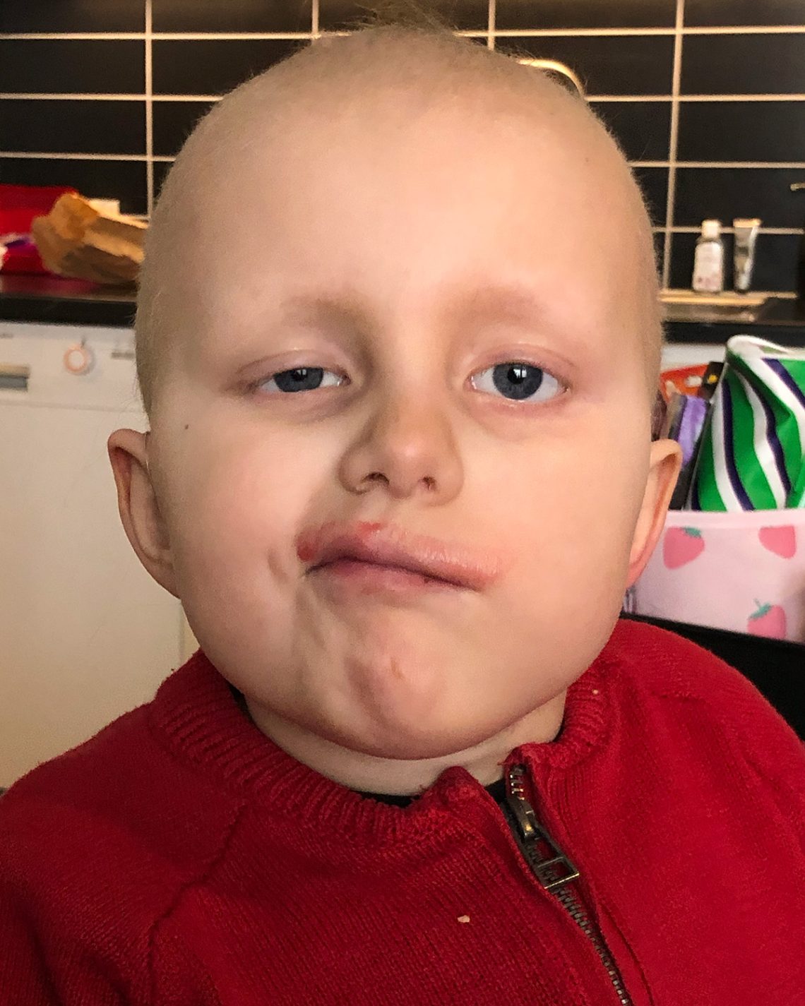 Elis gör en grimas med blåbärssoppemustasch