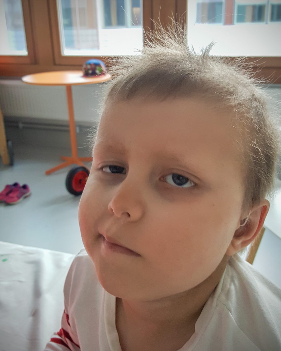 Elis med en klurig min, i sjukhusskjorta