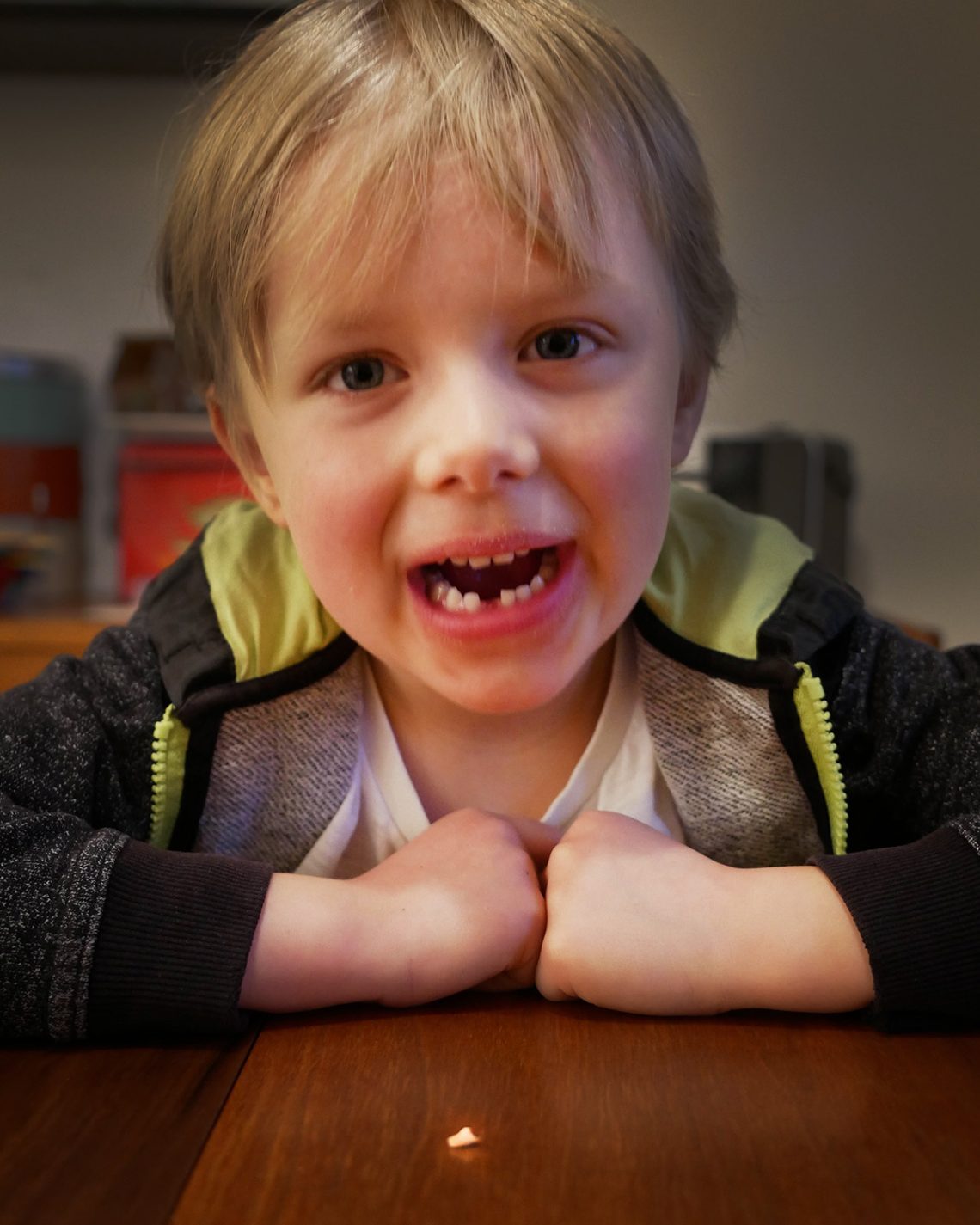 Folke gapar och visar att han tappat en tand, som ligger framför honom.