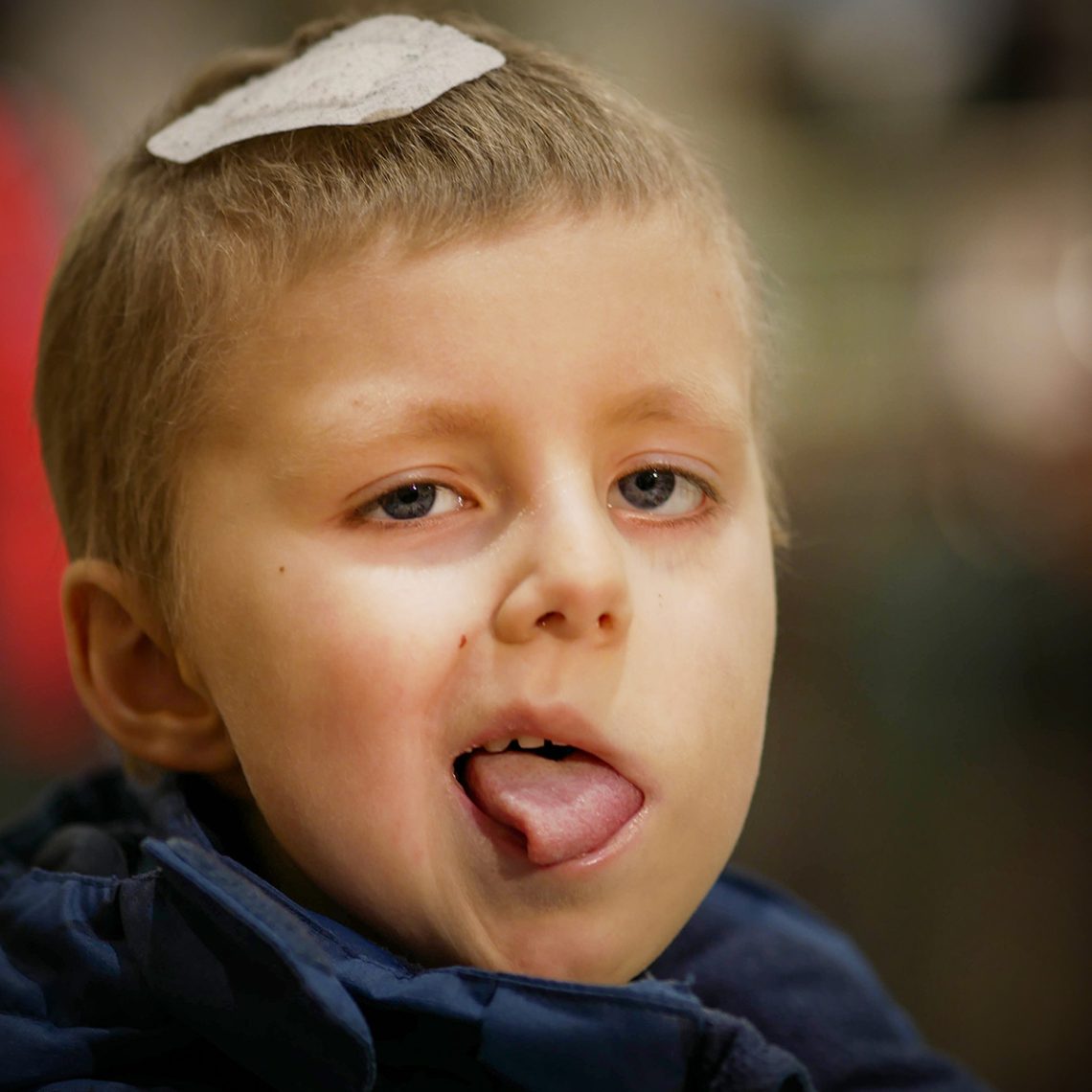 Elis, november 2018, med en kompress på huvudet.